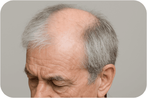 白髪和脫髮問題