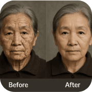 Facial restoration case